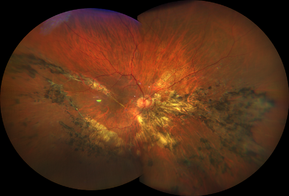 Imaging Wide Field e Ultra Wide Field